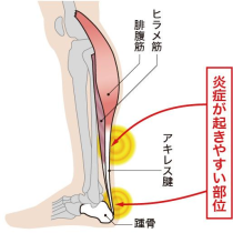 KENDO SUPPORTER [ACHILLES EX]